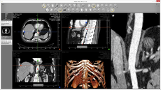 cpr - curve reconstructions