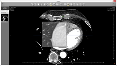 magnification in dicom viewer