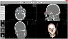 magnification in dicom viewer