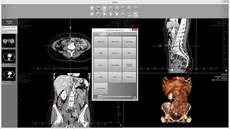 Segmentation of selected organs